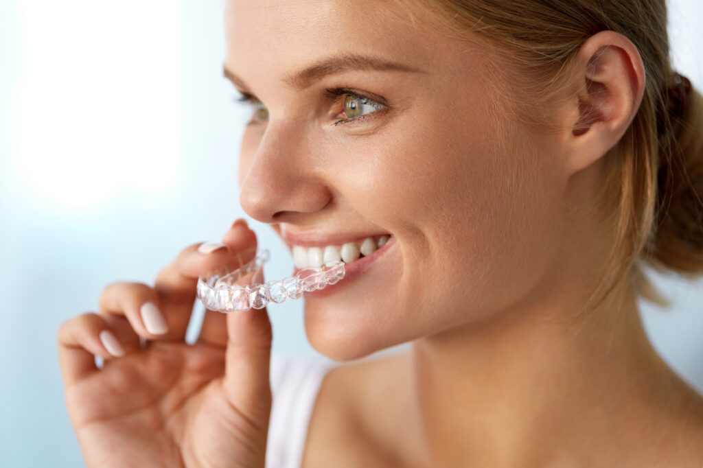 Allineatori Invisalign a Saluzzo